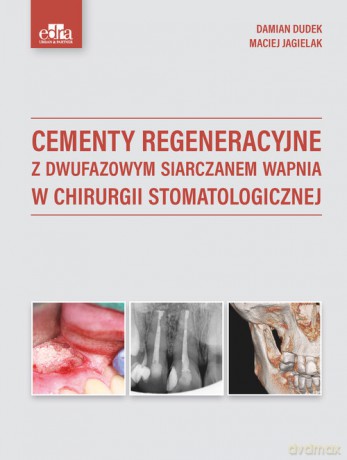 Cementy regeneracyjne z dwufazowym siarczanem wapnia w chirurgii stomatologicznej - Dudek D., M. Jagielak [KSIĄŻKA]