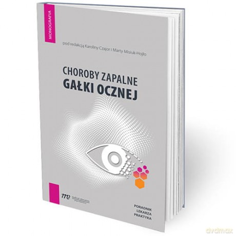Choroby zapalne gałki ocznej - poradnik lekarza praktyka [KSIĄŻKA]