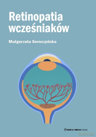 Retinopatia wcześniaków - Małgorzata Seroczyńska [KSIĄŻKA]