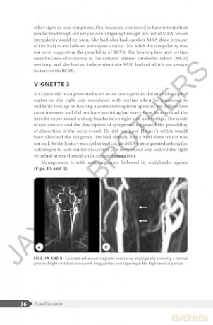 An Overview of Headaches - V Natarajan [KSIĄŻKA]