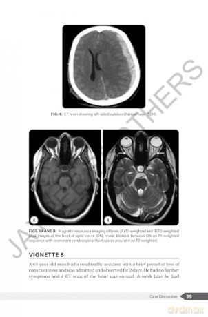 An Overview of Headaches - V Natarajan [KSIĄŻKA]