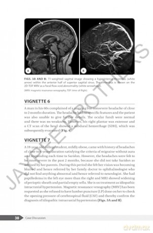 An Overview of Headaches - V Natarajan [KSIĄŻKA]