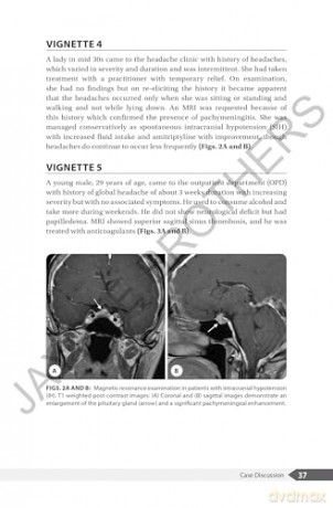 An Overview of Headaches - V Natarajan [KSIĄŻKA]