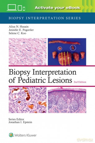 Biopsy Interpretation of Pediatric Lesions: Print + eBook with Multimedia: Biopsy Interpretation Series - Aliya Noor Husain M.D. [KSIĄŻKA]
