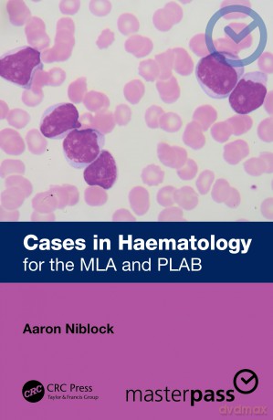 Cases in Haematology: for the MLA and PLAB (MasterPass) - Aaron Niblock [KSIĄŻKA]