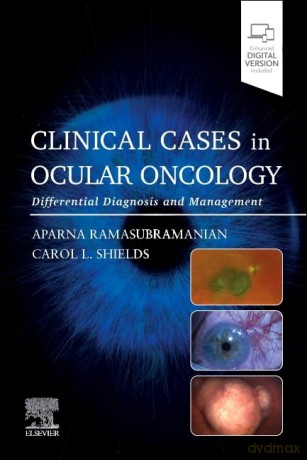 Clinical Cases in Ocular Oncology: Differential Diagnosis and Management - Aparna Ramasubramanian MD [KSIĄŻKA]