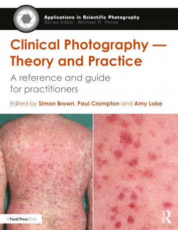 Clinical Photography - Theory and Practice: A Reference and Guide for Practitioners (Applications in Scientific Photography) - Simon Brown [KSIĄŻKA]