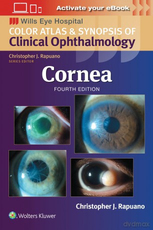 Cornea: Print + eBook with Multimedia (Wills Eye Institute Atlas Series) - Christopher J Rapuano MD [KSIĄŻKA]