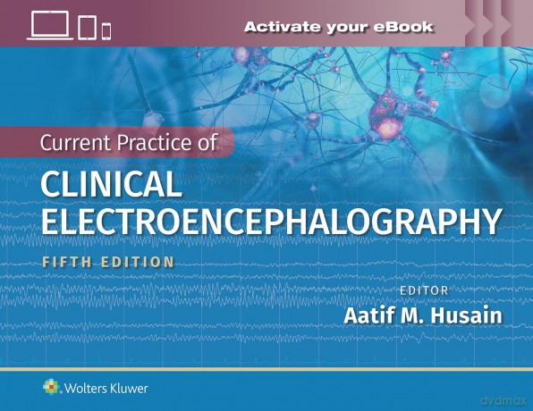Current Practice of Clinical Electroencephalography - Dr. Aatif M. Husain MD [KSIĄŻKA]