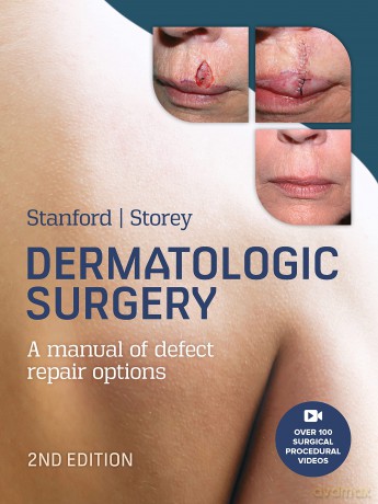 Dermatologic Surgery, 2nd Edition - Duncan Stanford [KSIĄŻKA]
