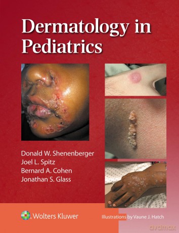 Dermatology in Pediatrics - Donald William Shenenberger [KSIĄŻKA]