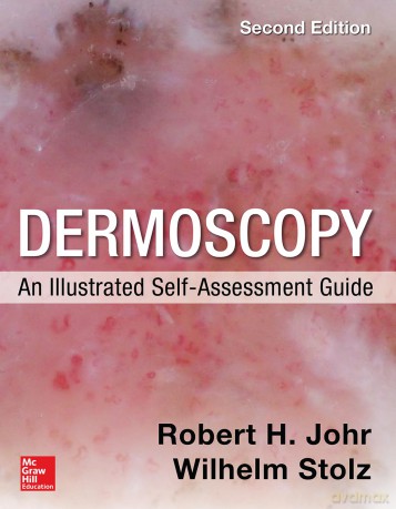 Dermoscopy: An Illustrated Self-Assessment Guide, 2/e (DERMATOLOGY) - Robert Johr [KSIĄŻKA]