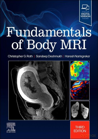 Fundamentals of Body MRI (Fundamentals of Radiology) - Christopher G. Roth MD [KSIĄŻKA]