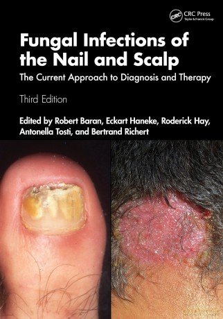 Fungal Infections of the Nail and Scalp: The Current Approach to Diagnosis and Therapy - Robert Baran [KSIĄŻKA]