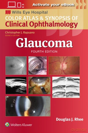 Glaucoma: Wills Eye Institute Atlas Series - Douglas J. Rhee [KSIĄŻKA]