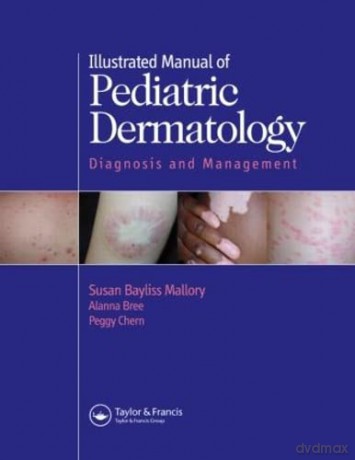 Illustrated Manual of Pediatric Dermatology: Diagnosis and Management - Susan Mallory [KSIĄŻKA]