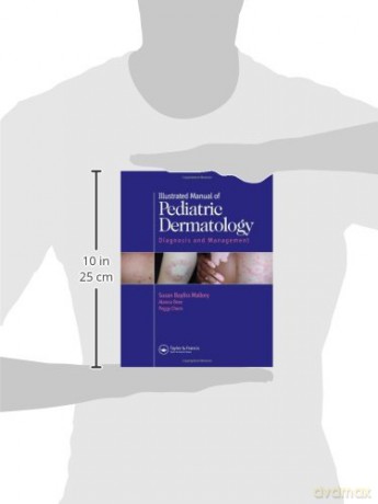 Illustrated Manual of Pediatric Dermatology: Diagnosis and Management - Susan Mallory [KSIĄŻKA]