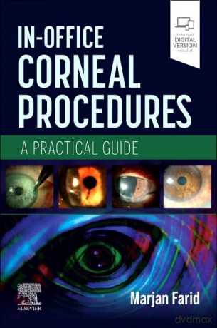 In-Office Corneal Procedures: A Practical Guide - Marjan Farid MD [KSIĄŻKA]