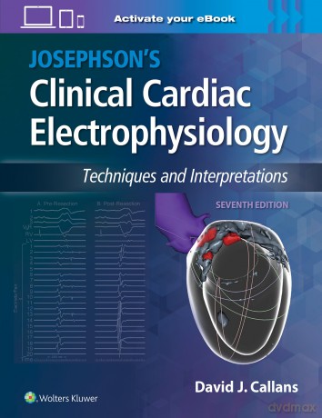 Josephson's Clinical Cardiac Electrophysiology: Techniques and Interpretations - David Callans [KSIĄŻKA]