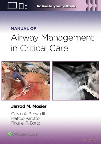 Manual of Airway Management in Critical Care: Print + eBook with Multimedia - Jarrod Mosier MD PLLC [KSIĄŻKA]