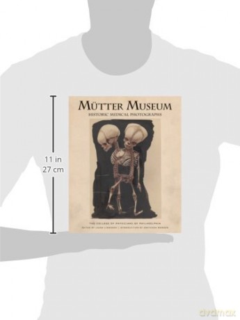 Mütter Museum Historic Medical Photographs: The College of Physicians of Philadelphia - College of Physicians of Philadelphia [KSIĄŻKA]