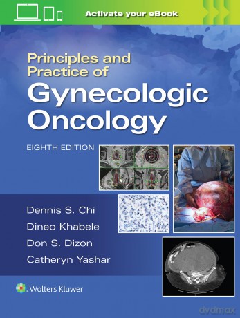 Principles and Practice of Gynecologic Oncology - Dennis Chi [KSIĄŻKA]