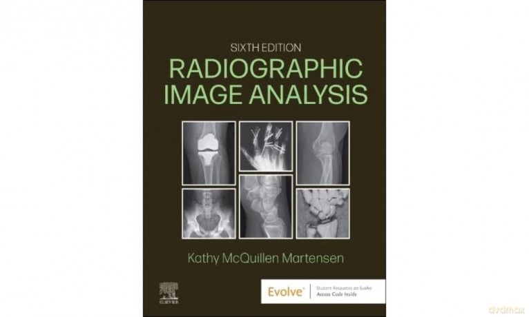 Radiographic Image Analysis - Kathy McQuillen Martensen MA RT(R) [KSIĄŻKA]