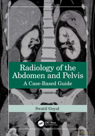 Radiology of the Abdomen and Pelvis: A Case-Based Guide - Swati Goyal [KSIĄŻKA]