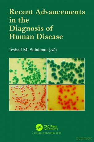 Recent Advancements in the Diagnosis of Human Disease - Irshad M. Sulaiman [KSIĄŻKA]