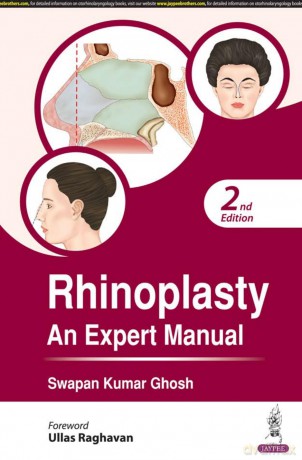 Rhinoplasty: An Expert Manual - Swapan Kumar Ghosh [KSIĄŻKA]