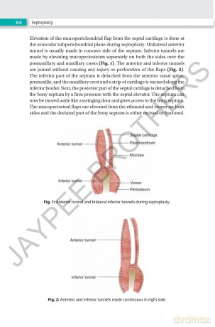 Rhinoplasty: An Expert Manual - Swapan Kumar Ghosh [KSIĄŻKA]