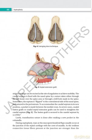 Rhinoplasty: An Expert Manual - Swapan Kumar Ghosh [KSIĄŻKA]