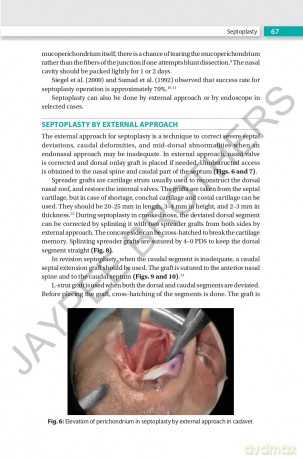 Rhinoplasty: An Expert Manual - Swapan Kumar Ghosh [KSIĄŻKA]