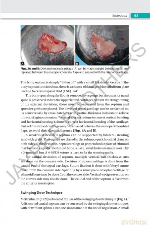 Rhinoplasty: An Expert Manual - Swapan Kumar Ghosh [KSIĄŻKA]
