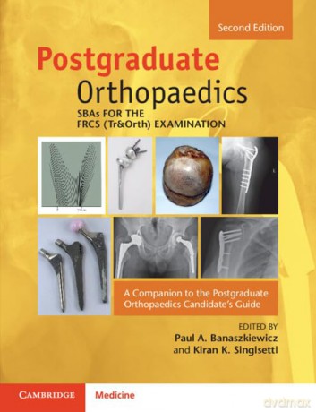 SBAs for the FRCS (Tr&Orth) Examination: A Companion to the Postgraduate Orthopaedics Candidate's Guide - Kiran Singisetti Edited by Paul A. Banaszkiewicz [KSIĄŻKA]