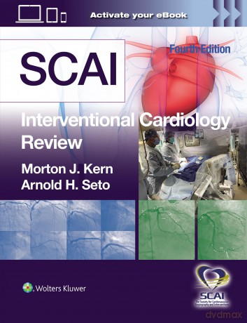 SCAI Interventional Cardiology Review [KSIĄŻKA]