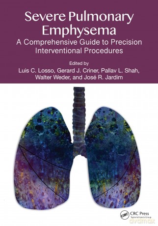 Severe Pulmonary Emphysema:: A Comprehensive Guide to Precision Interventional Procedures - Luis C. Losso [KSIĄŻKA]