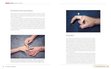 The Climbing Bible: Managing Injuries: Injury prevention and rehabilitation for climbing and bouldering: 3 - Stian Christophersen [KSIĄŻKA]