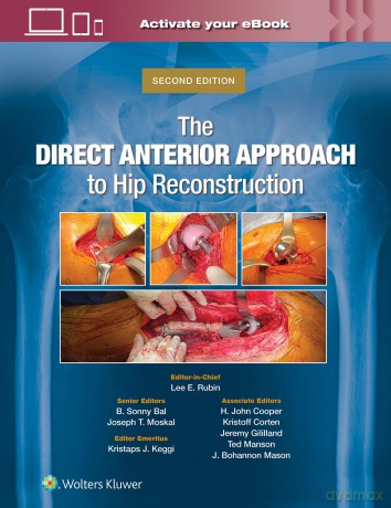 The Direct Anterior Approach to Hip Reconstruction - Lee E. Rubin [KSIĄŻKA]