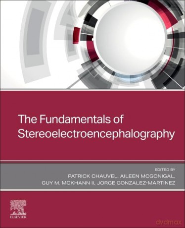 The Fundamentals of Stereoelectroencephalography - Patrick Chauvel MD [KSIĄŻKA]