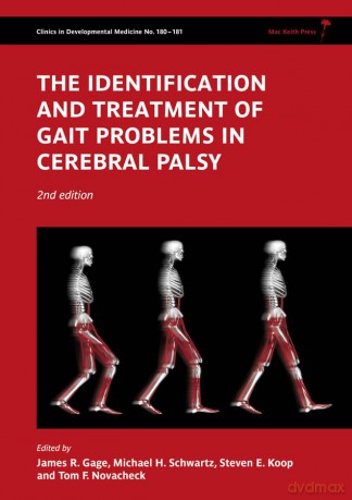 The Identification and Treatment of Gait Problems in Cerebral Palsy (Clinics in Developmental Medicine) - James R. Gage [KSIĄŻKA]