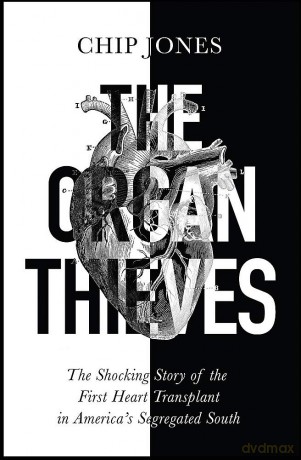 The Organ Thieves: The Shocking Story of the First Heart Transplant in America's Segregated South - Chip Jones [KSIĄŻKA]