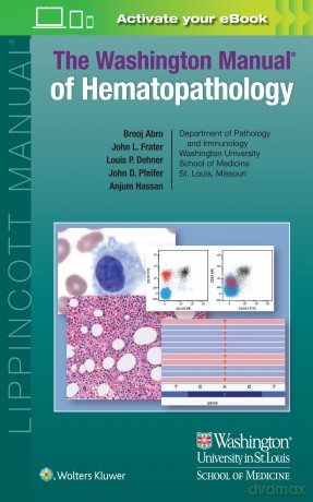 The Washington Manual of Hematopathology: Print + eBook with Multimedia - Brooj Abro MD [KSIĄŻKA]