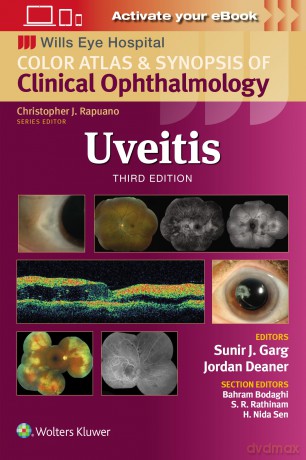 Uveitis: Wills Eye Institute Atlas Series - Sunir J. Garg [KSIĄŻKA]