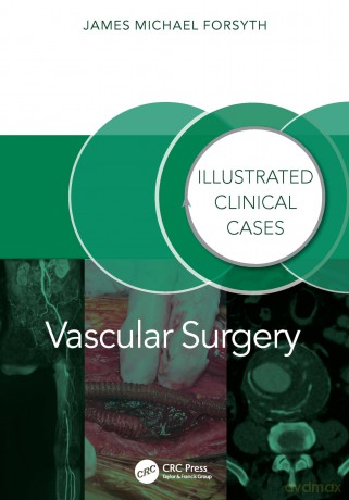 Vascular Surgery:: Illustrated Clinical Cases - James Forsyth [KSIĄŻKA]