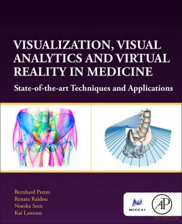 Visualization, Visual Analytics and Virtual Reality in Medicine: State-of-the-art Techniques and Applications (The MICCAI Society book Series) - Bernhard Preim [KSIĄŻKA]