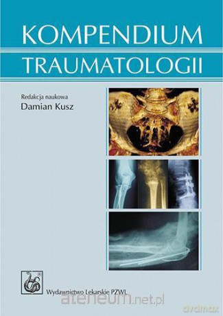 Kompendium traumatologii [KSIĄŻKA]