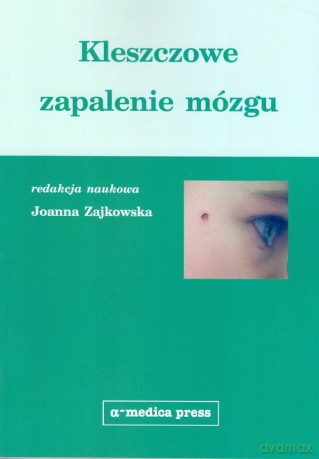 Kleszczowe zapalenie mózgu - Joanna Zajkowska [KSIĄŻKA]