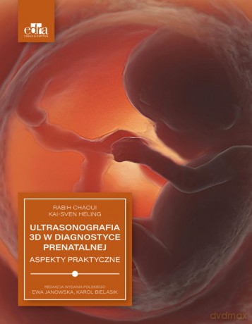 Ultrasonografia 3D w diagnostyce prenatalnej - Chaoui R. [KSIĄŻKA]