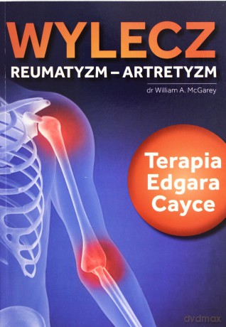 Wylecz reumatyzm - artretyzm. Terapia Edgara Cayce [KSIĄŻKA]